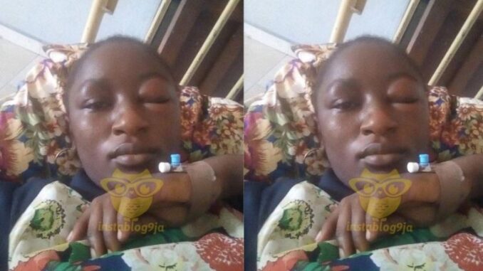 Woman Cries Out From Hospital Bed After Being Beaten By Her Husband
